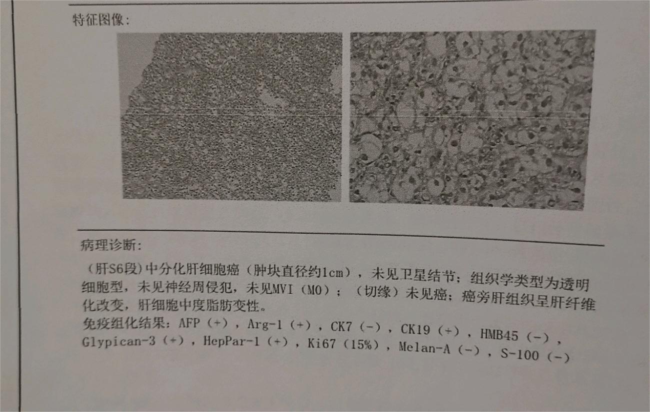 我还能活多久